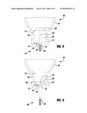 PULL PUMPS, REFILL UNITS AND DISPENSERS FOR PULL PUMPS diagram and image