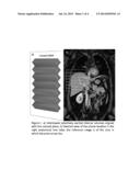 Method for Detection of Characteristics of Organ Fibrosis diagram and image