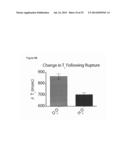 METHOD FOR DIAGNOSING OR TREATING TUMORS USING SPHINGOMYELIN CONTAINING     LIPOSOMES diagram and image