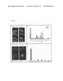 METHOD FOR DIAGNOSING OR TREATING TUMORS USING SPHINGOMYELIN CONTAINING     LIPOSOMES diagram and image