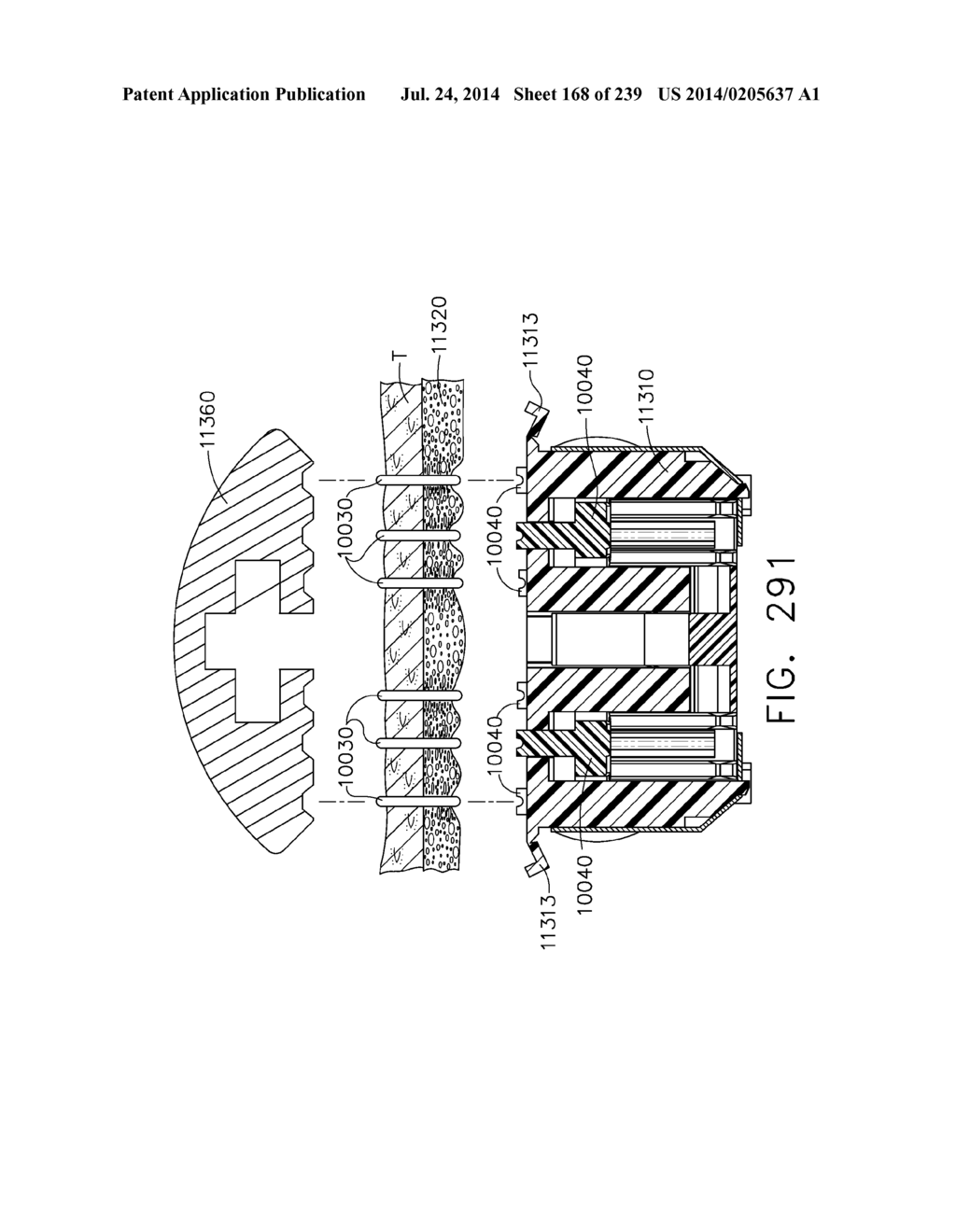 TISSUE THICKNESS COMPENSATOR CONFIGURED TO REDISTRIBUTE COMPRESSIVE FORCES - diagram, schematic, and image 169