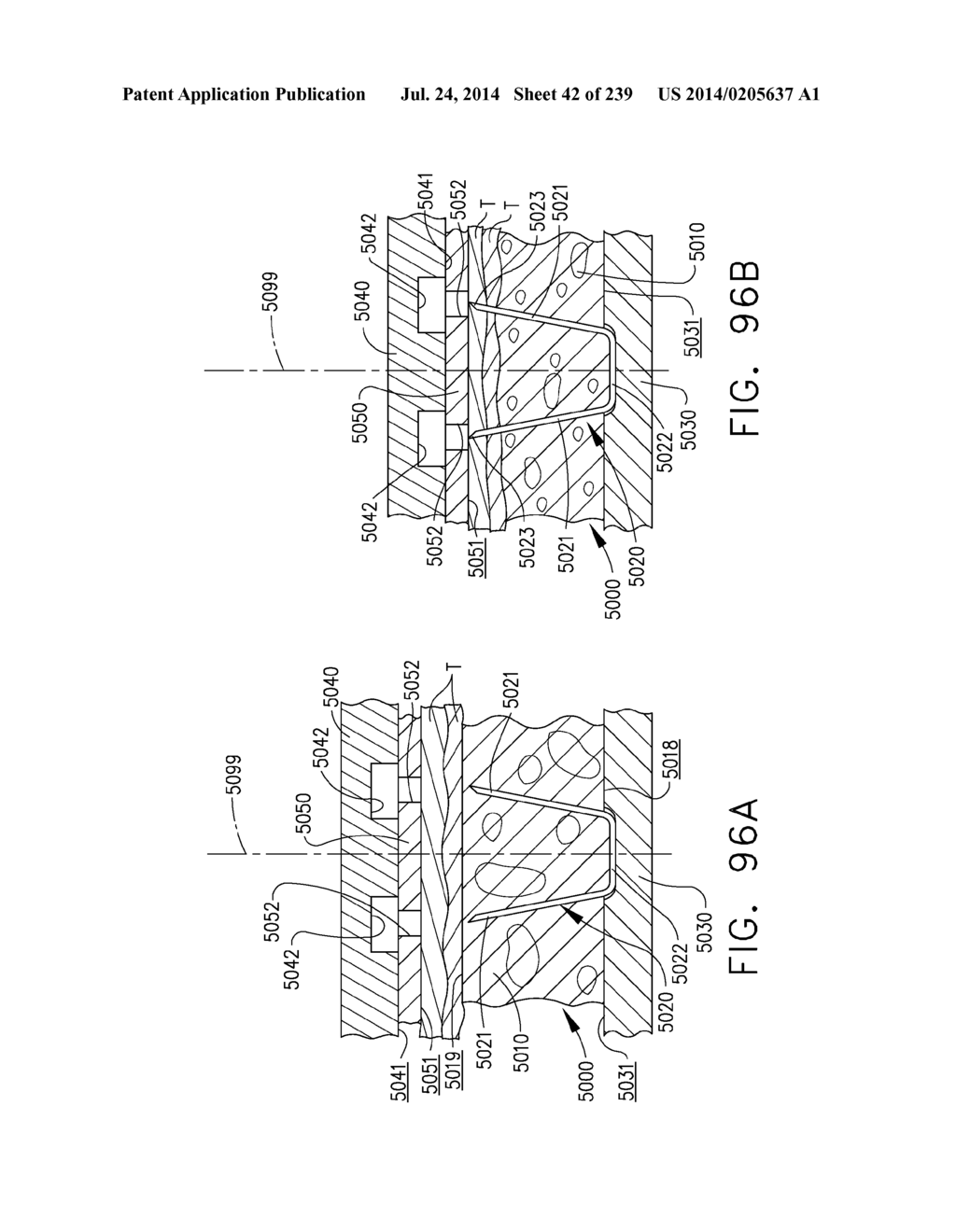 TISSUE THICKNESS COMPENSATOR CONFIGURED TO REDISTRIBUTE COMPRESSIVE FORCES - diagram, schematic, and image 43