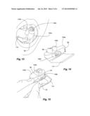 Sleeve for Cutting Bur for Dental Cutting Guide diagram and image