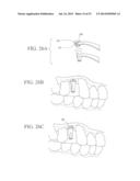 Universal Aligning Adaptor System and Methods diagram and image