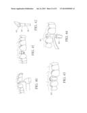 Universal Aligning Adaptor System and Methods diagram and image