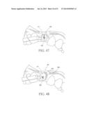 Universal Aligning Adaptor System and Methods diagram and image