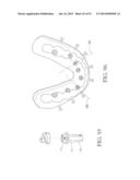 Universal Aligning Adaptor System and Methods diagram and image