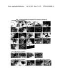 HUMAN PLURIPOTENT STEM CELLS INDUCED FROM UNDIFFERENTIATED STEM CELLS     DERIVED FROM A HUMAN POSTNATAL TISSUE diagram and image