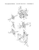 CONSTANT VELOCITY JOINT diagram and image