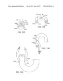 SIDE LOOKING MINIMALLY INVASIVE SURGERY INSTRUMENT ASSEMBLY diagram and image