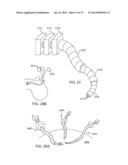 SIDE LOOKING MINIMALLY INVASIVE SURGERY INSTRUMENT ASSEMBLY diagram and image