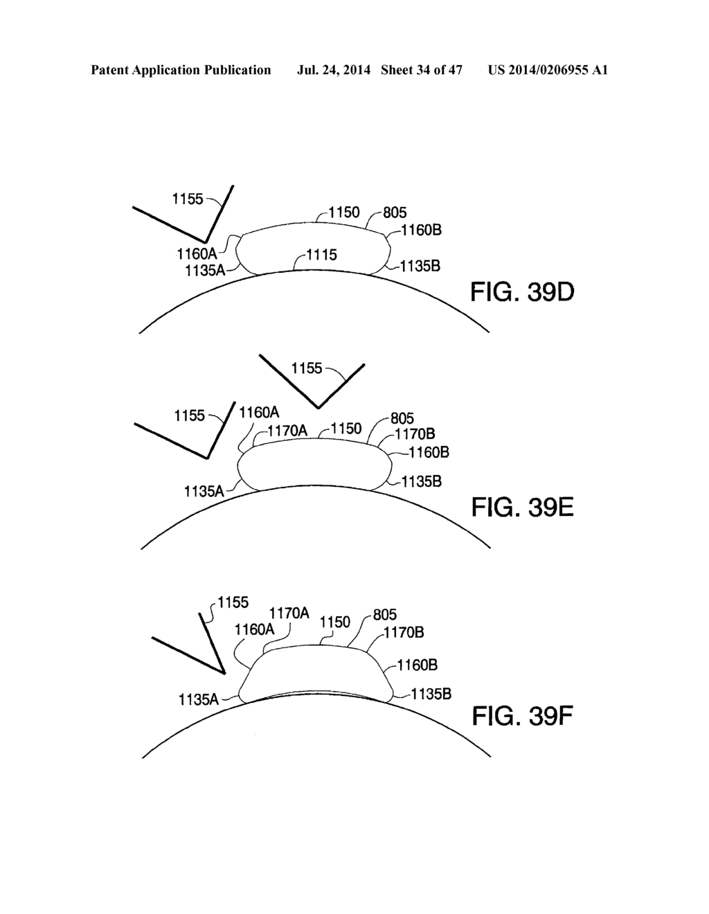 WRIST-WORN BODY MONITORING DEVICE - diagram, schematic, and image 35