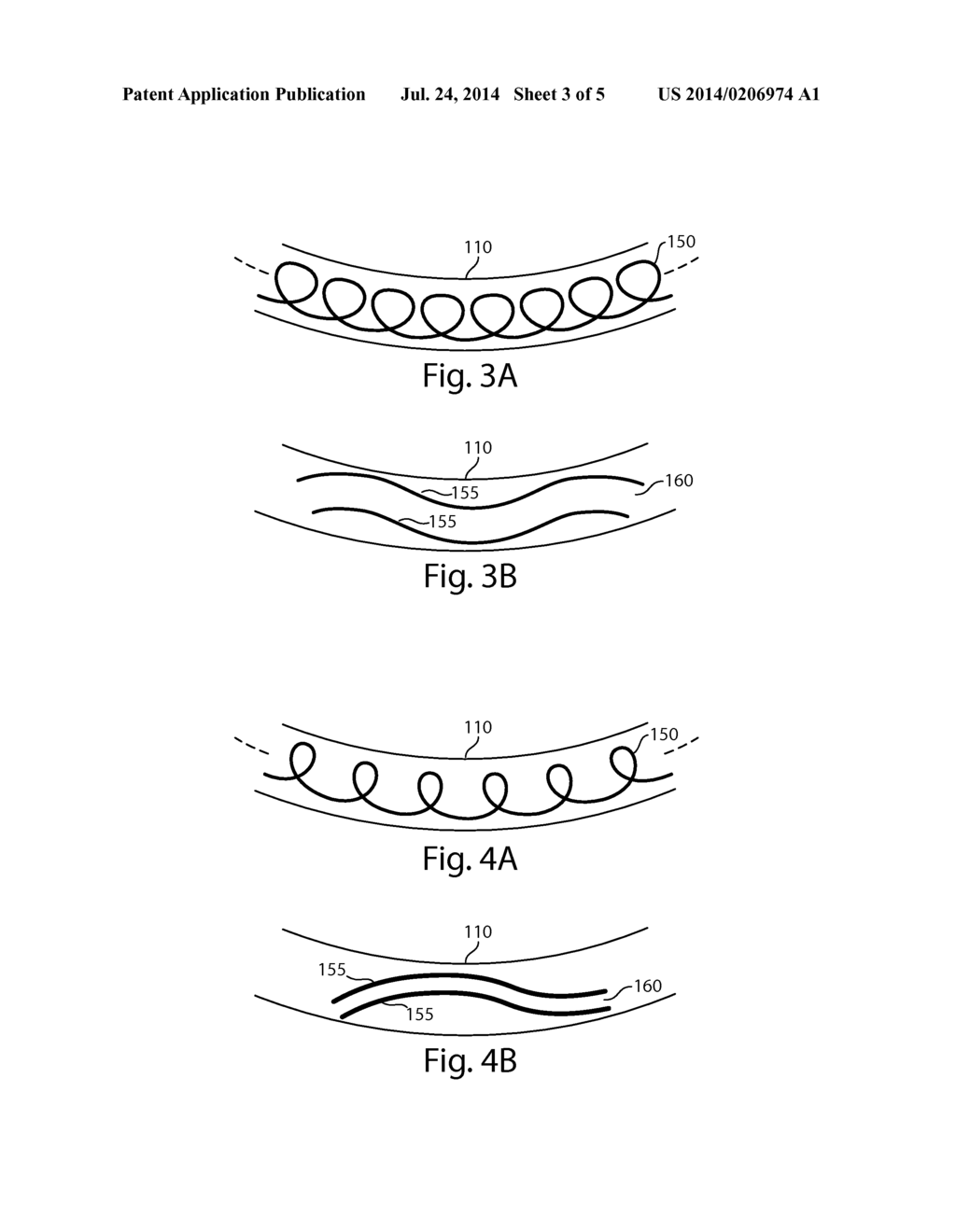 WEARABLE MONITORING AND TREATMENT DEVICE - diagram, schematic, and image 04