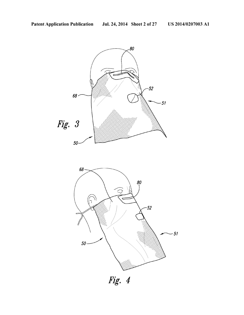 SYSTEMS AND METHODS FOR DETECTION OF DISEASE INCLUDING ORAL SCOPES AND     AMBIENT LIGHT MANAGEMENT SYSTEMS (ALMS) - diagram, schematic, and image 03