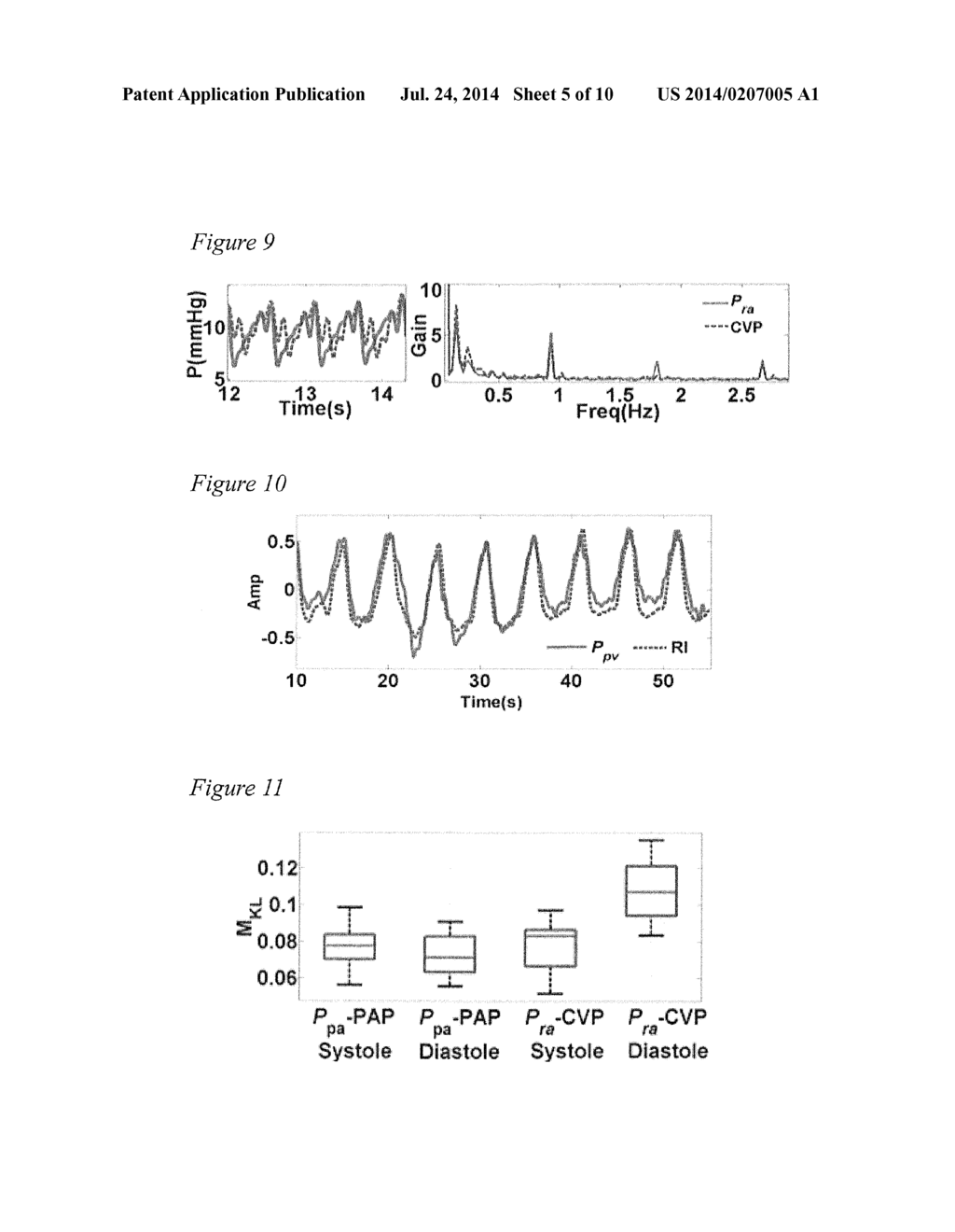 SYSTEM AND METHOD FOR REAL-TIME THREE DIMENSIONAL MODELING OF     CARDIOVASCULAR DYNAMICS AND THE HEART USING ELECTROCARDIOGRAM SIGNALS - diagram, schematic, and image 06