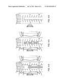 MICRO-ADJUSTABLE TELESCOPING ARMS FOR ORTHOPEDIC BRACES diagram and image