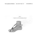 Dynamic Hallux Tension Device For Treatment of Plantar Faciitis diagram and image