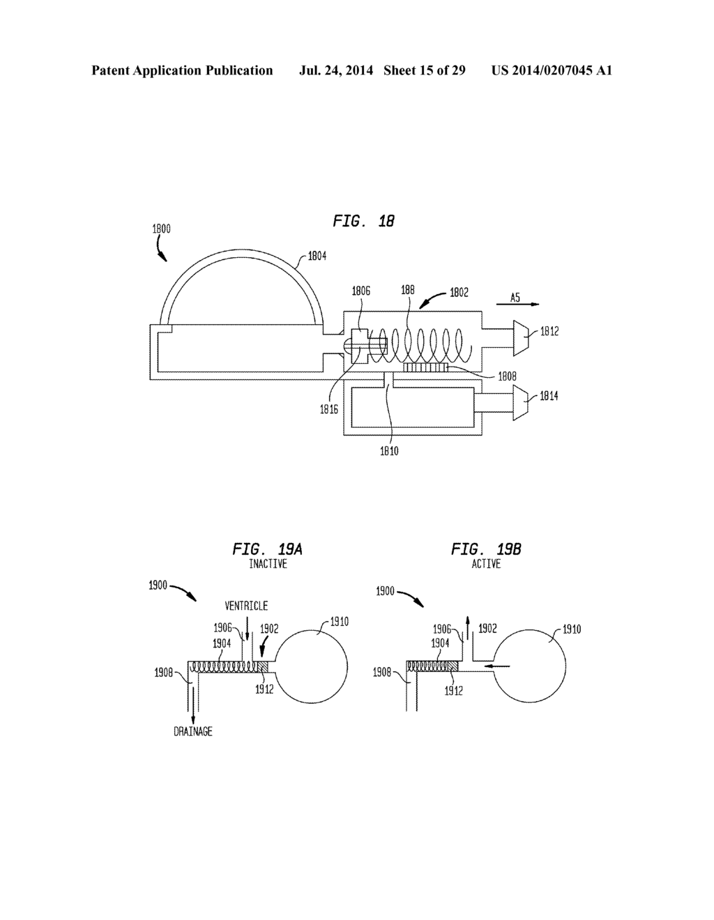 SYSTEMS AND METHODS FOR SHUNTING FLUID - diagram, schematic, and image 16