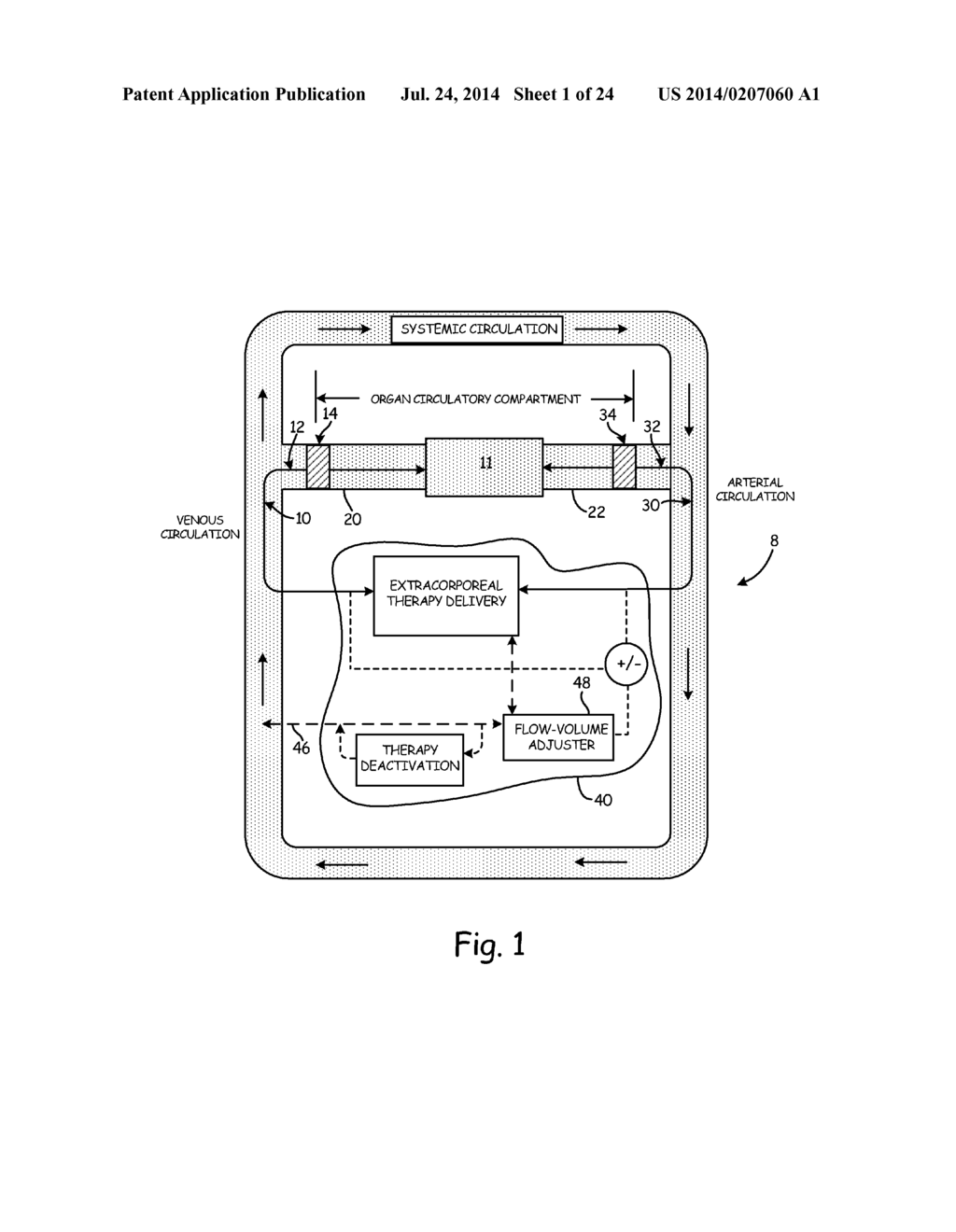 Localized Therapy Delivery and Local Organ Protection - diagram, schematic, and image 02