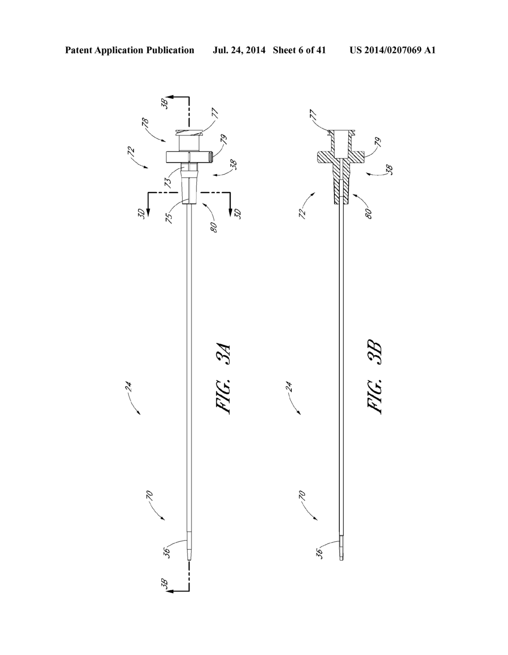 ACCESS DEVICE WITH VALVE - diagram, schematic, and image 07