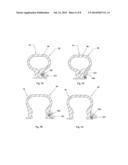 ORAL TRANSMUCOSAL DRUG DELIVERY DEVICE diagram and image