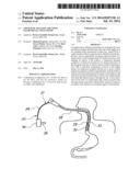 CRYOGENIC BALLOON ABLATION INSTRUMENTS AND SYSTEMS diagram and image