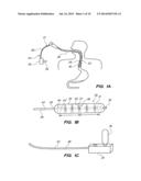 CRYOGENIC BALLOON ABLATION INSTRUMENTS AND SYSTEMS diagram and image