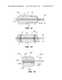 CRYOGENIC BALLOON ABLATION INSTRUMENTS AND SYSTEMS diagram and image