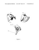 CONTOUR LOCK GUIDES diagram and image