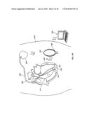 LEADLESS CARDIAC STIMULATION SYSTEMS diagram and image