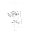 LEADLESS CARDIAC STIMULATION SYSTEMS diagram and image