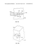 LEADLESS CARDIAC STIMULATION SYSTEMS diagram and image