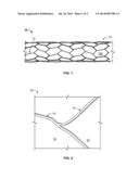 SYSTEMS AND DEVICES FOR CEREBRAL ANEURYSM REPAIR diagram and image