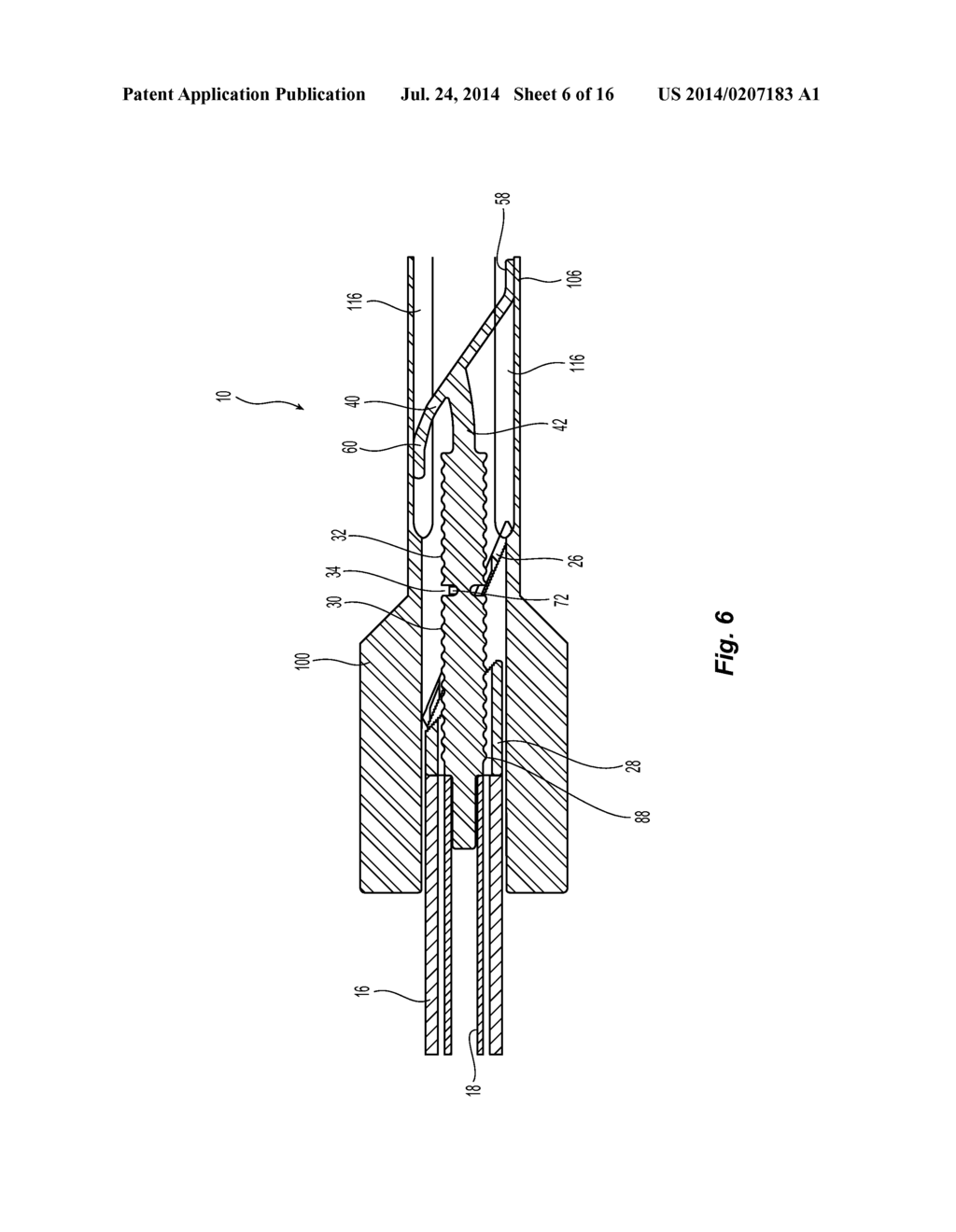 Vessel Sealing Device with Automatic Deployment - diagram, schematic, and image 07