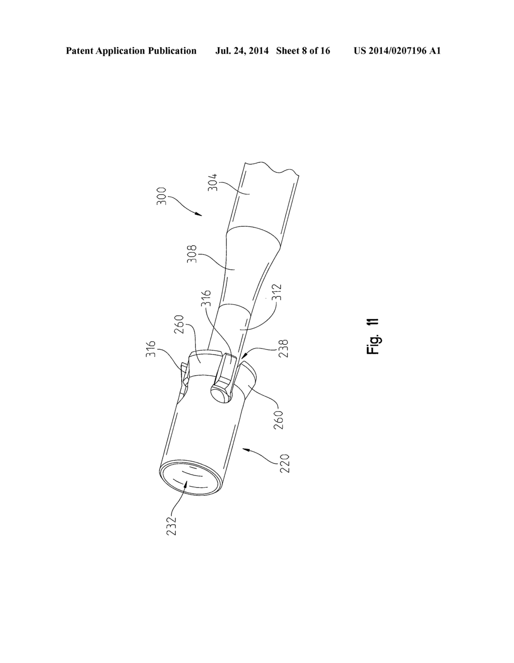 Limited Collapse Surgical Screws - diagram, schematic, and image 09