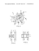 TOOLS FOR IMPLANTATION OF INTERSPINOUS IMPLANTS AND METHODS THEROF diagram and image