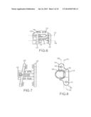 TOOLS FOR IMPLANTATION OF INTERSPINOUS IMPLANTS AND METHODS THEROF diagram and image