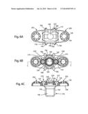 Spinous Process Fusion Implants and Insertion, Compression, and Locking     Instrumentation diagram and image