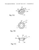 Spinous Process Fusion Implants and Insertion, Compression, and Locking     Instrumentation diagram and image
