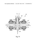 Spinous Process Fusion Implants and Insertion, Compression, and Locking     Instrumentation diagram and image