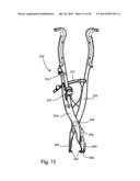 Spinous Process Fusion Implants and Insertion, Compression, and Locking     Instrumentation diagram and image