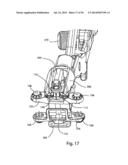 Spinous Process Fusion Implants and Insertion, Compression, and Locking     Instrumentation diagram and image