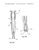 Spinous Process Fusion Implants and Insertion, Compression, and Locking     Instrumentation diagram and image