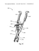 Spinous Process Fusion Implants and Insertion, Compression, and Locking     Instrumentation diagram and image