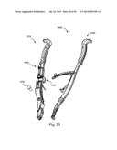 Spinous Process Fusion Implants and Insertion, Compression, and Locking     Instrumentation diagram and image