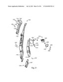 Spinous Process Fusion Implants and Insertion, Compression, and Locking     Instrumentation diagram and image