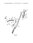 Spinous Process Fusion Implants and Insertion, Compression, and Locking     Instrumentation diagram and image