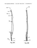 Spinous Process Fusion Implants and Insertion, Compression, and Locking     Instrumentation diagram and image