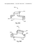 Spinous Process Fusion Implants and Insertion, Compression, and Locking     Instrumentation diagram and image