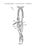 Spinous Process Fusion Implants and Insertion, Compression, and Locking     Instrumentation diagram and image